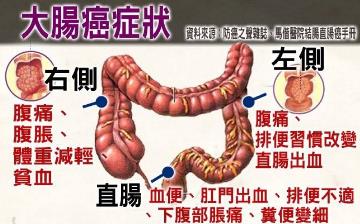 【大肠癌】早期肠癌自检方法及早期信号症状_什么样的腹痛是肠癌